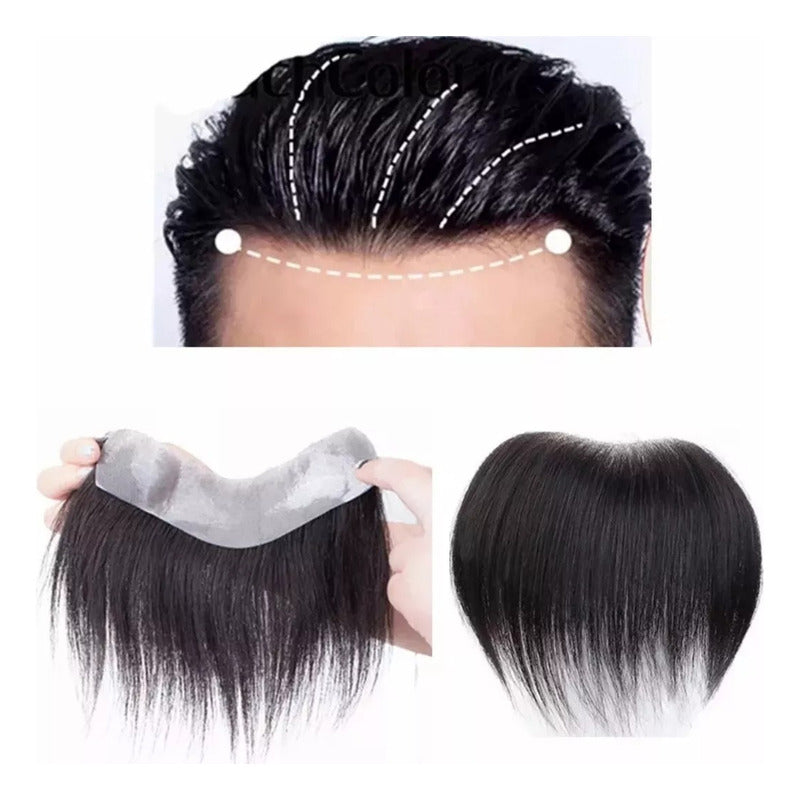 Tupé Hombre Y Mujer De Cabello Natural 100% Humano