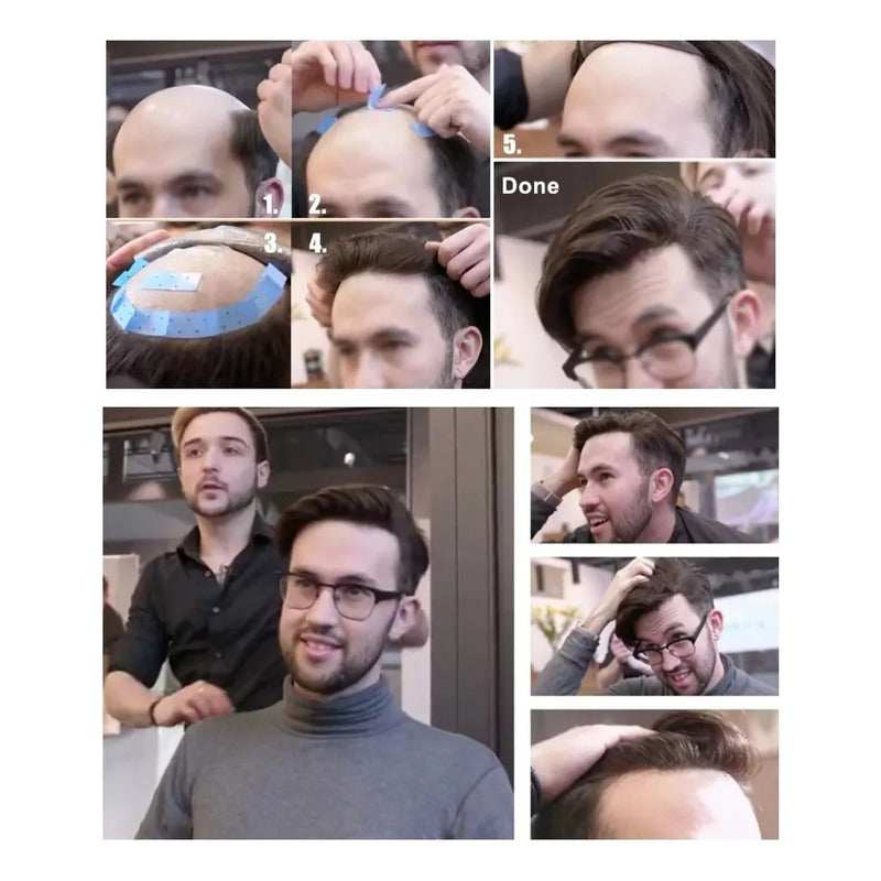 Tupé Hombre Y Mujer De Cabello Natural 100% Humano